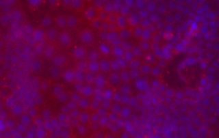 110521LPS30min2DapiNFkB Cells